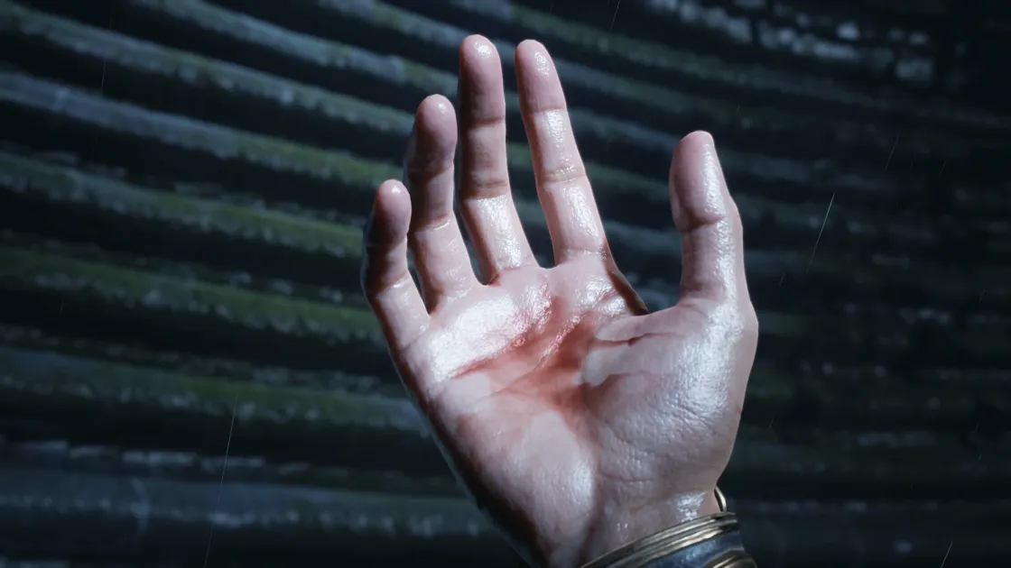 An open hand with blood on the palm.